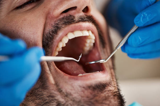 Best Emergency Broken Tooth Repair in Mount Prospect, IL